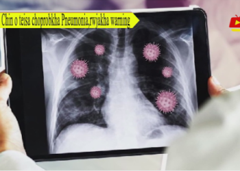 Chin o teisa choprobkha Pneumonia,rwjakha warning